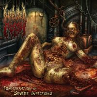 Infected Flesh – Concatenation Of Severe Infections